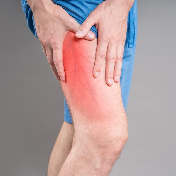 Varicose veins on male leg - medical photo of visible swollen veins, vascular disease concept on gray background