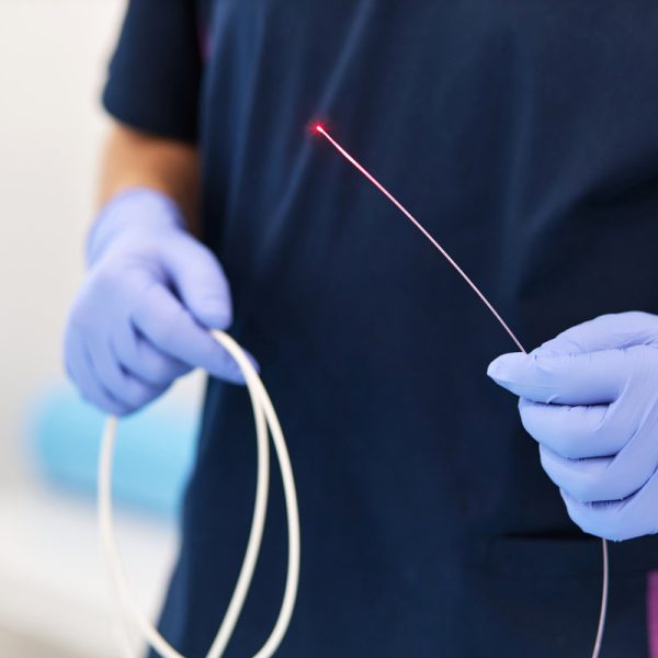 close-up of a doctor's hands are holding a laser for the treatment of varicose veins